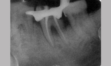 Dental care in Anand
                        